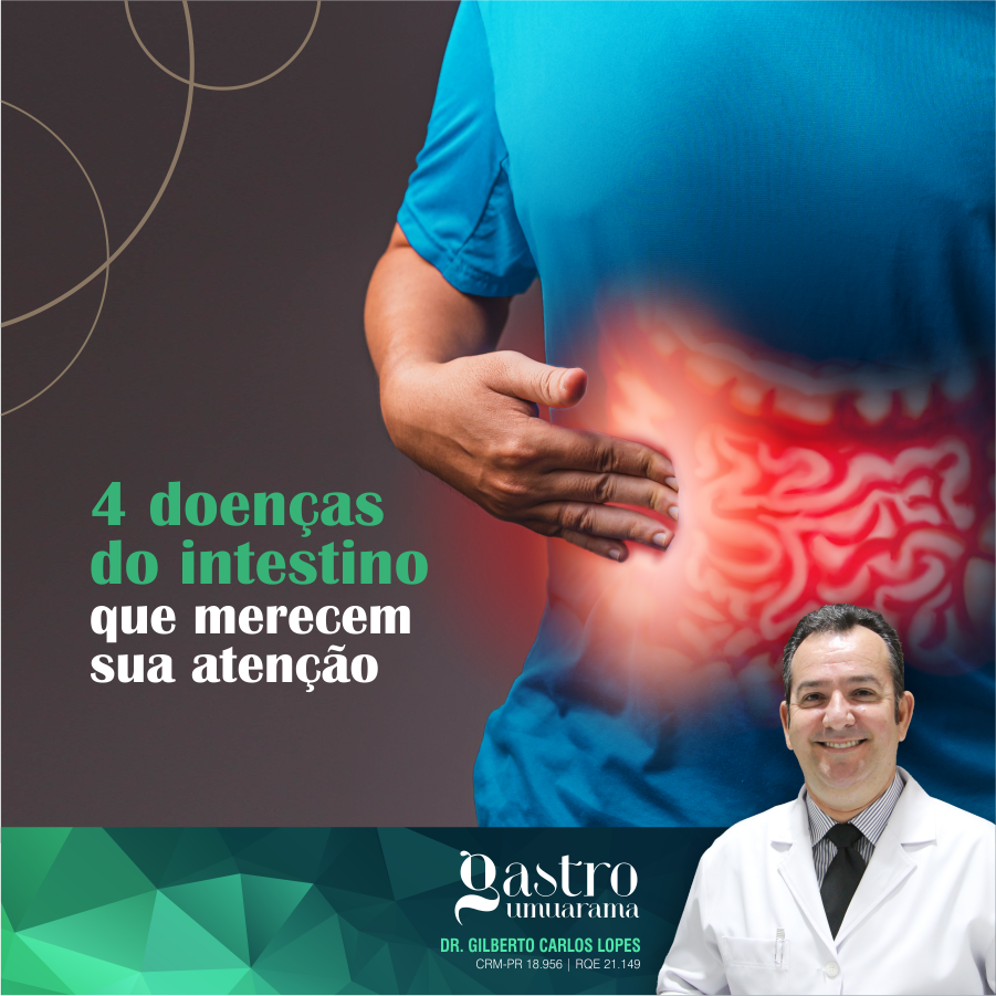 4 Doenças do Intestino que Merecem sua Atenção