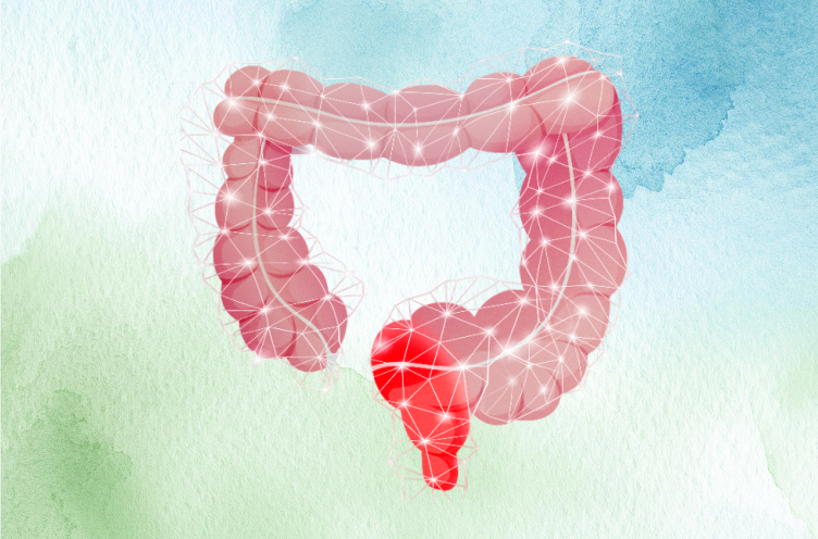 Câncer Colorretal | Prevenção
