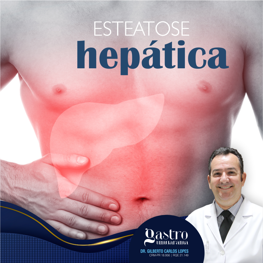 Esteatose Hepática | Gordura no Fígado