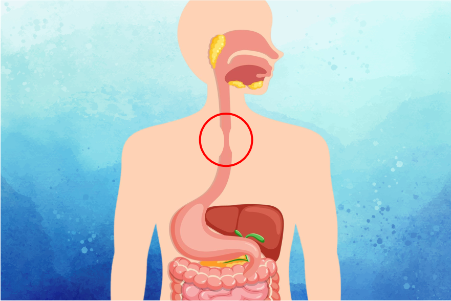 Você Tem Dificuldade para Engolir Alimentos?
