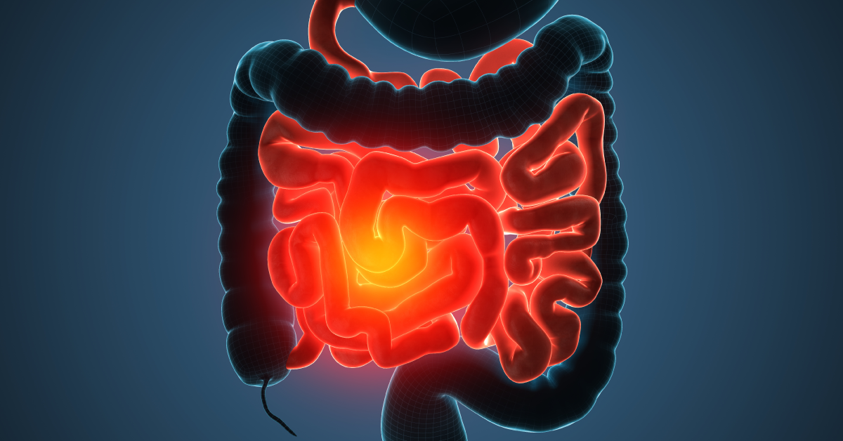 Problemas Gastrointestinais? Você não precisa conviver com eles.