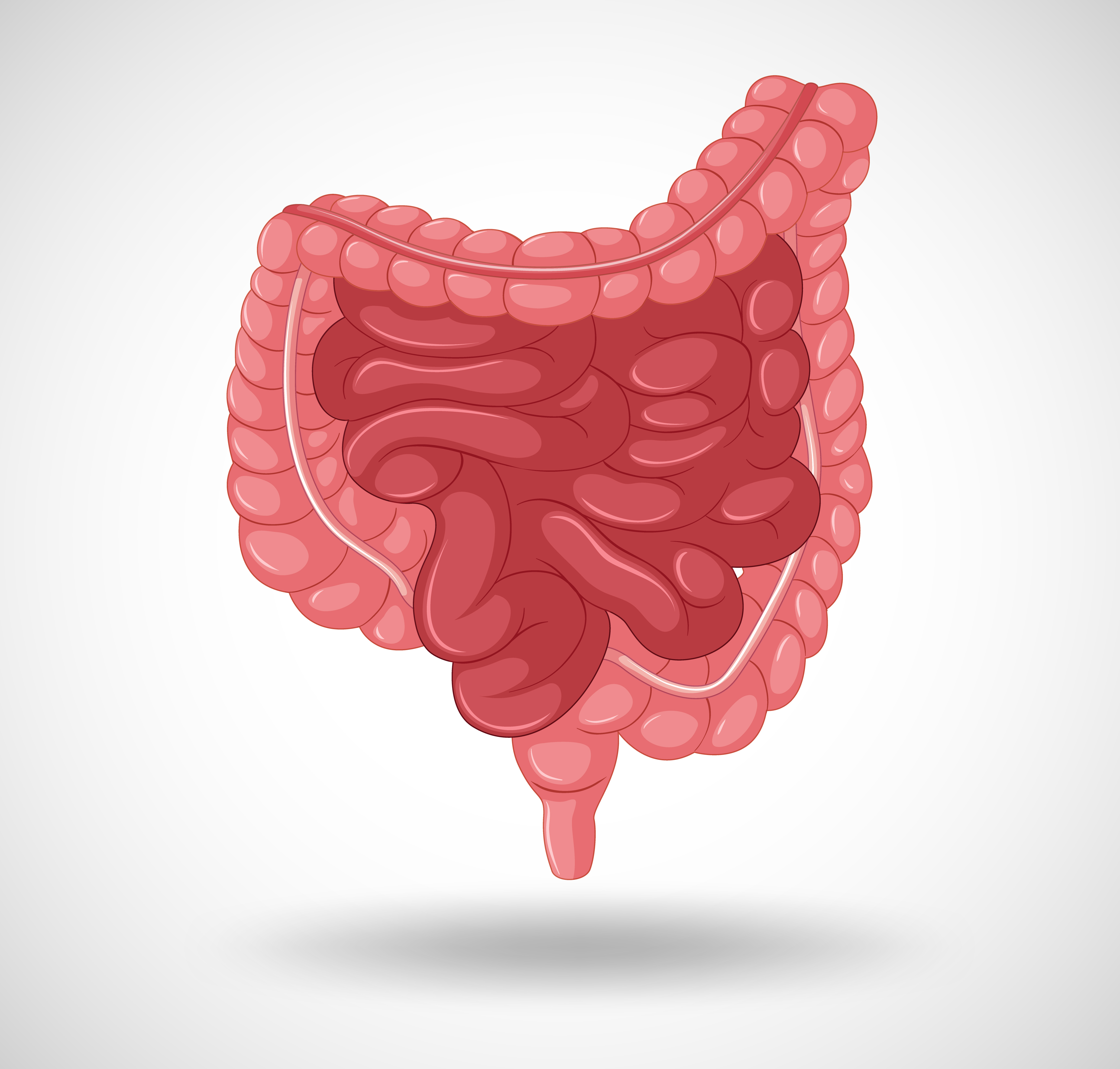 Colite | Inflamação Intestinal