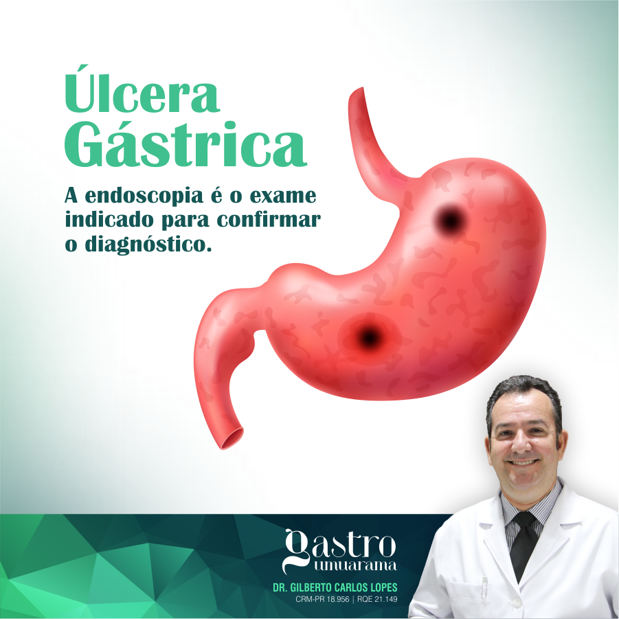 Úlcera Gástrica | Endoscopia