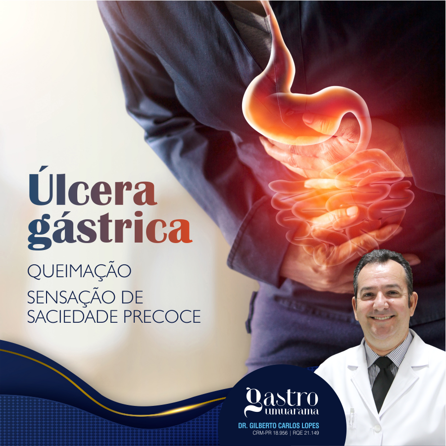 Causas da Úlcera Gástrica