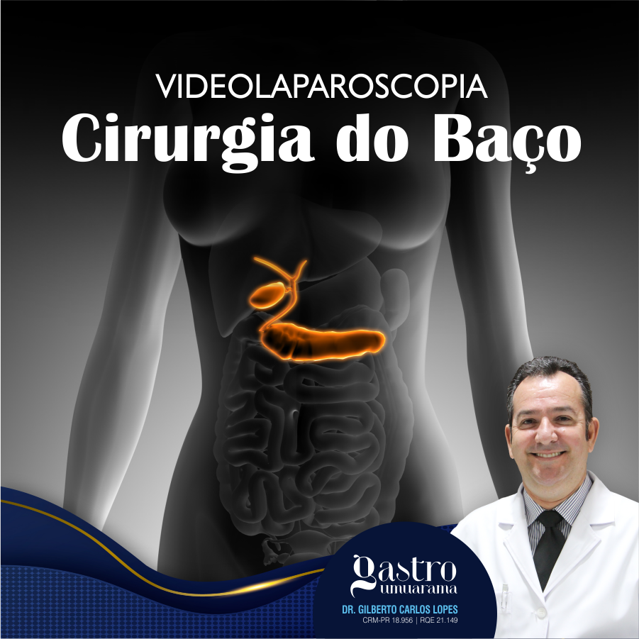 Cirurgia do Baço por Videolaparoscopia